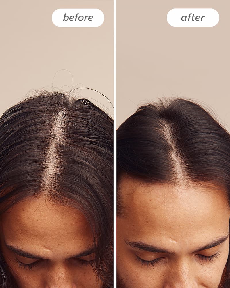 Instant Relief™ Duo - Image 7