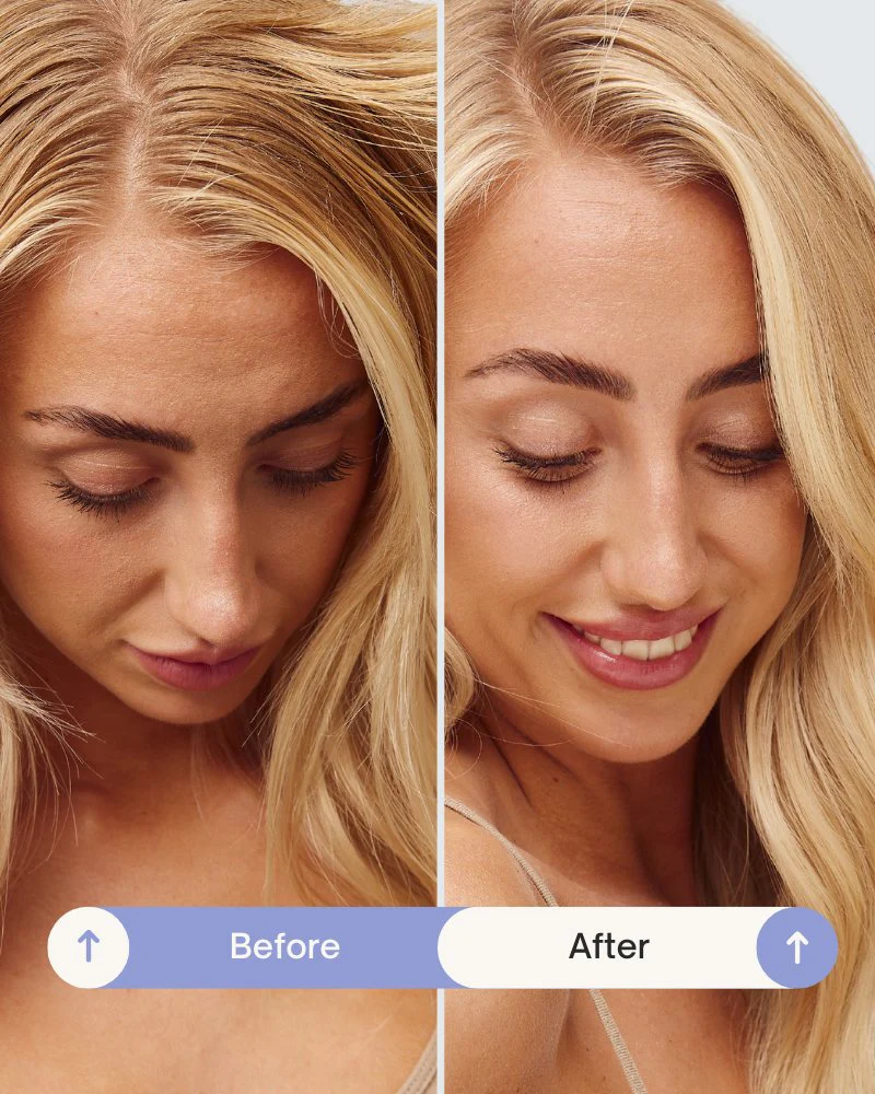 Refresh Powder™ Dry Shampoo - Image 3