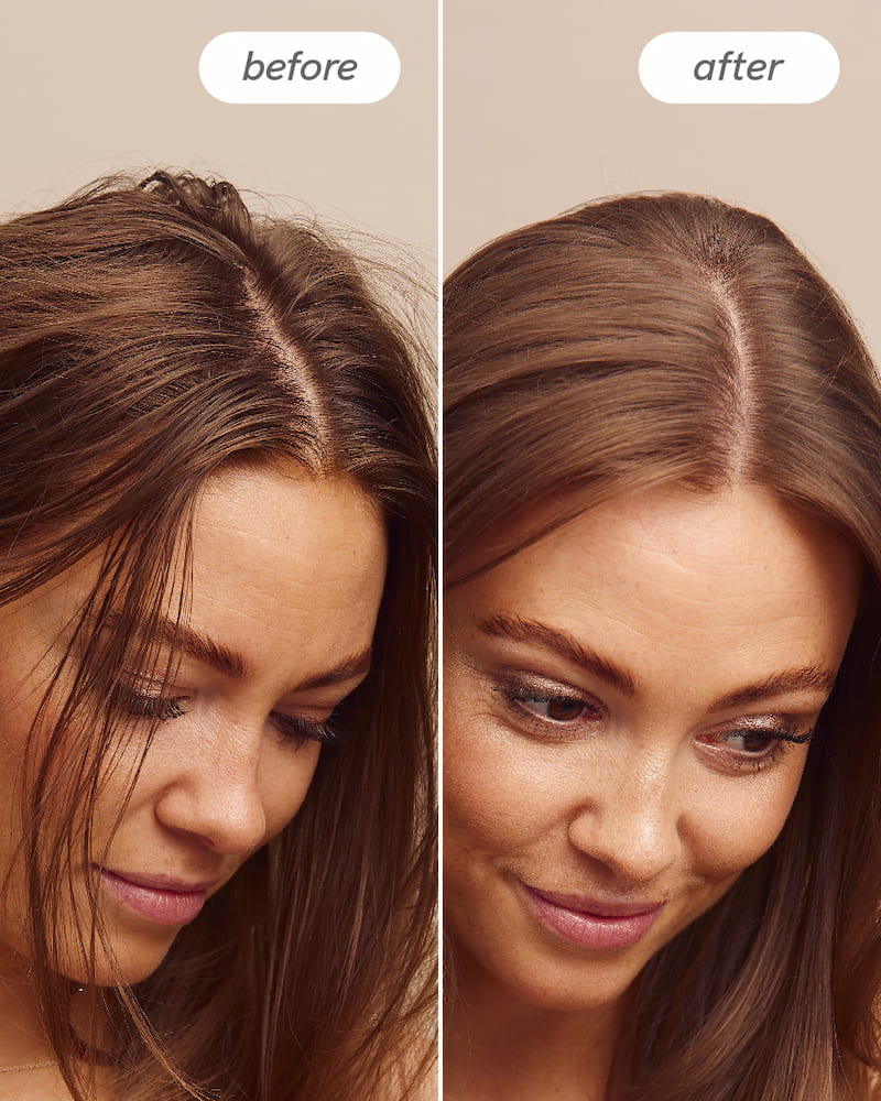Scalp Delight™ Bundle - Image 8